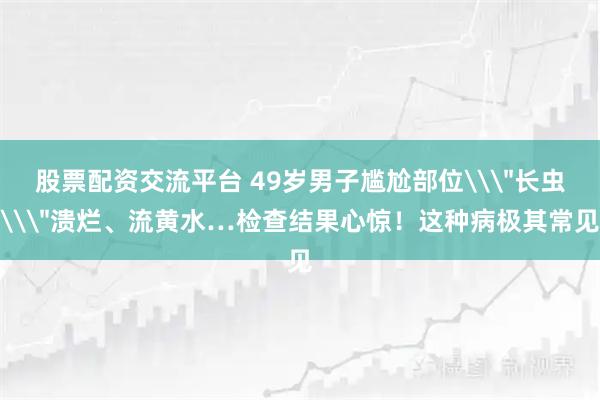 股票配资交流平台 49岁男子尴尬部位\＂长虫\＂溃烂、流黄水…检查结果心惊！这种病极其常见